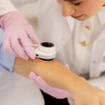 bőrgyógyászat korai diagnosztika