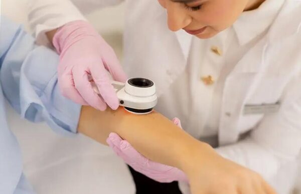bőrgyógyászat korai diagnosztika